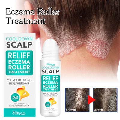 Scalp Eczema Care Roller, Hair Growth Roller, Used to Promote Hair Growth for Both Men and Women,18Ml, Beauty & Personal Care